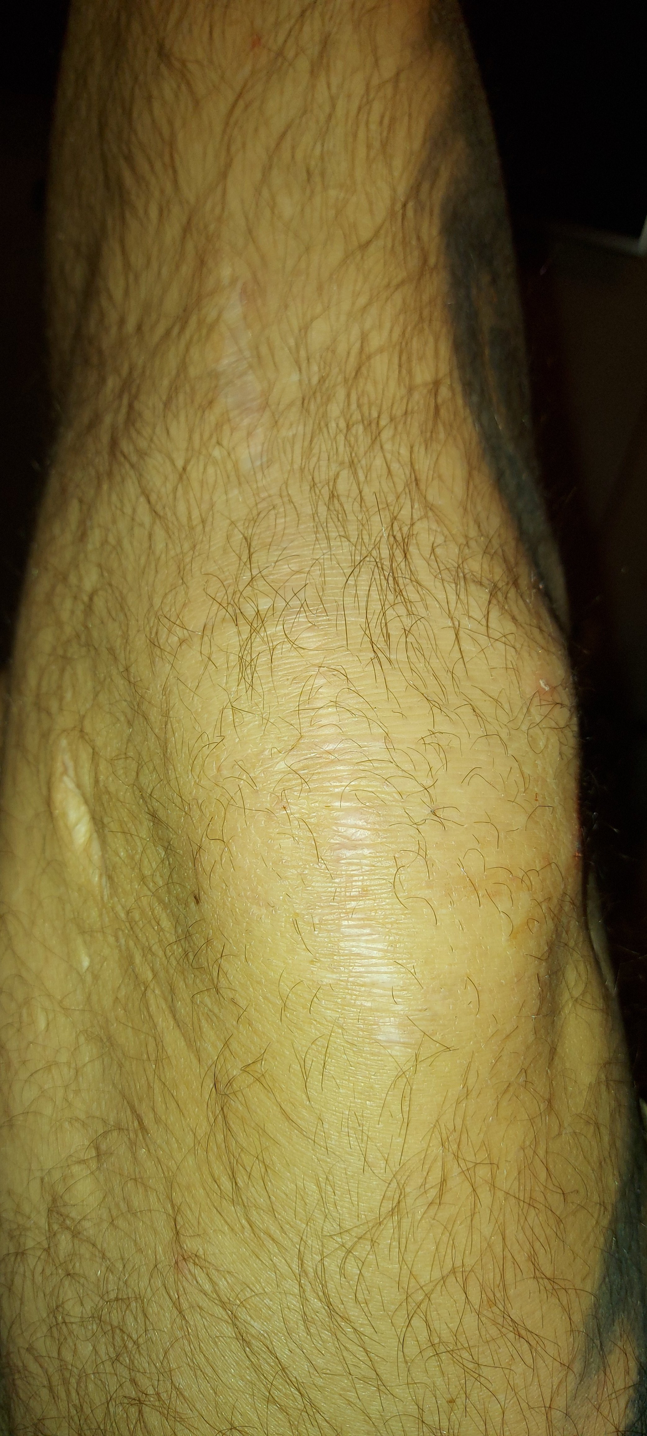 20201116_072215.jpg