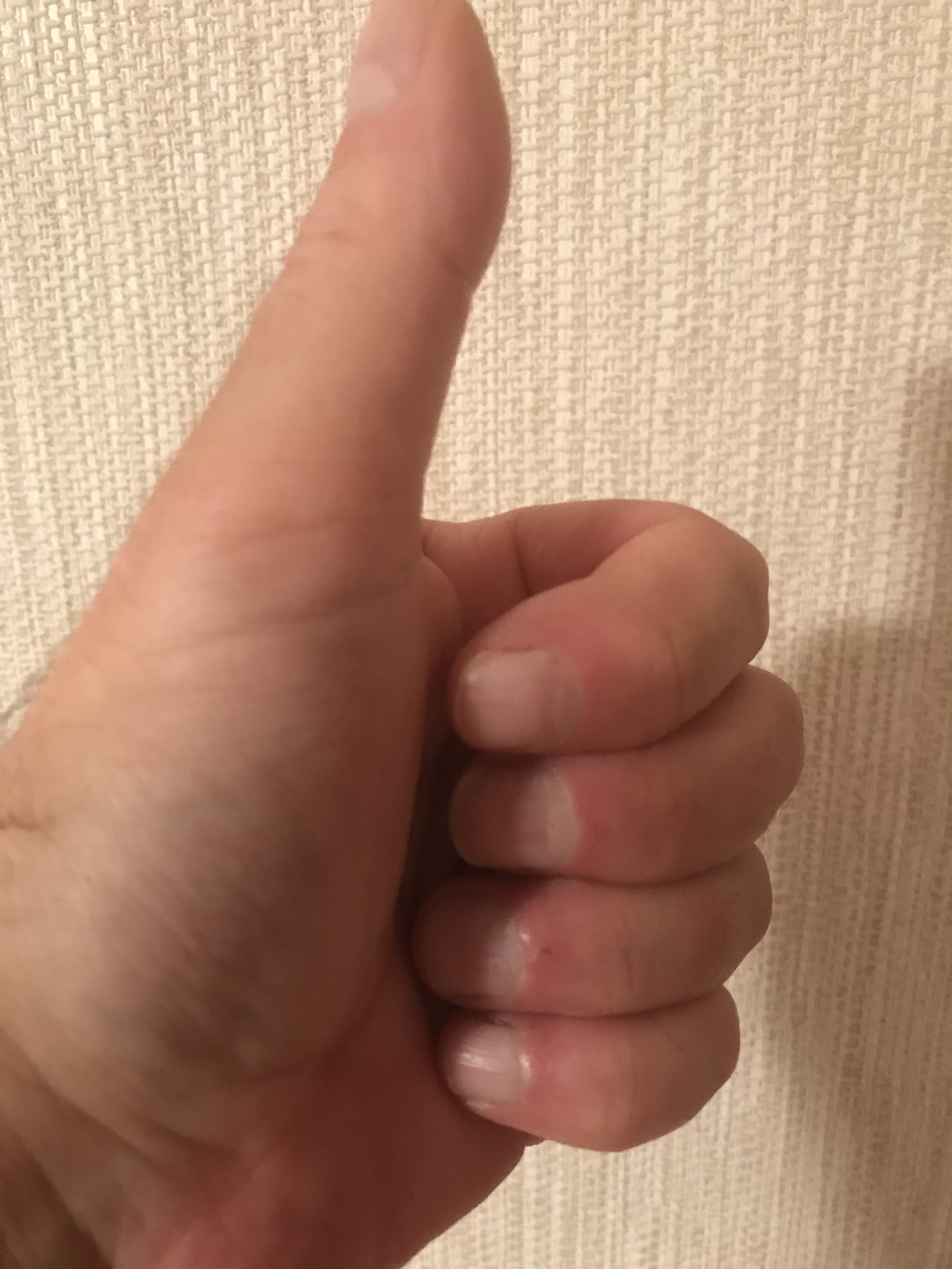 C57F2F00-ED9F-4091-A715-A5141FDCE262.jpeg